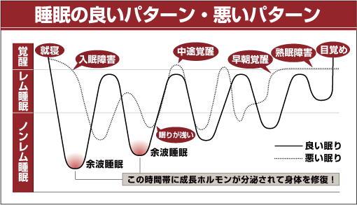 睡眠の良いパターン・悪いパターン