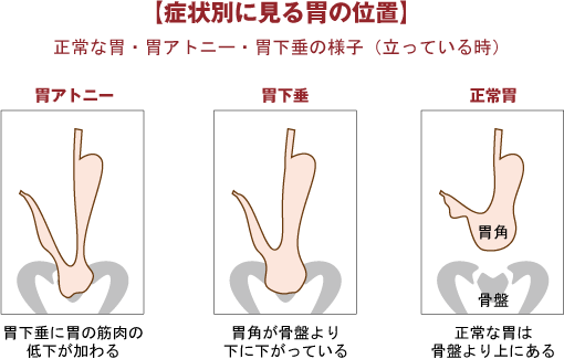 症状別に見る胃の位置