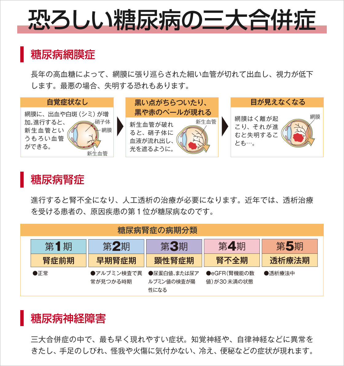 恐ろしい糖尿病の三大合併症