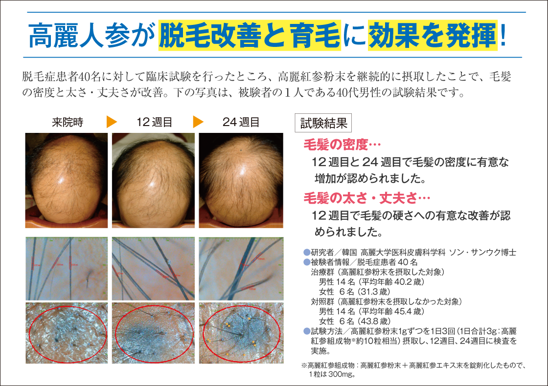 高麗人参が脱毛改善と育毛に効果を発揮!