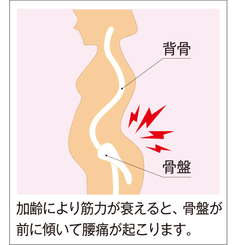 腰の痛み