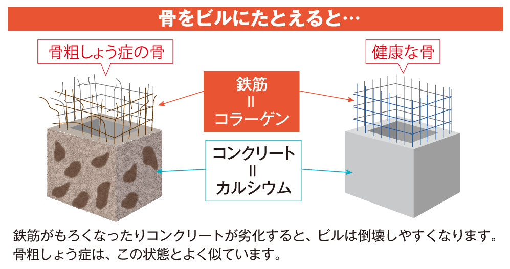 骨をビルにたとえると…